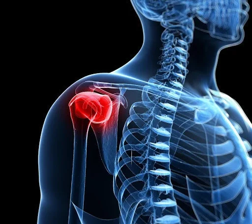 Shoulder pain treatment by chiropractor in California at Greenlight Chiropractic & Wellness Lab
